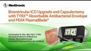 TYRX Antibacterial Envelope Instructional Video