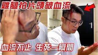 突發事件！雞腿拍片意外頭破血流，現場血流不止 生死一瞬間【希露弟弟啃雞腿】