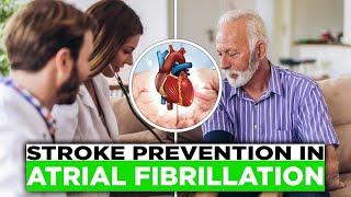 Stroke Prevention in Atrial Fibrillation: Beyond Anti-Clotting Drugs