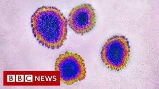 Coronavirus: Death toll rises to at least 427  - BBC News