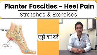 Physiotherapy for Planter Fascities | Best stretches and Home exercises