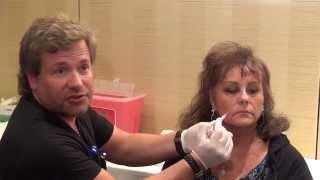 Dermal Filler Training - Nasolabial folds Injections - Empire Medical Training