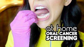 How To Screen For Oral Cancer At Home