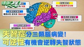 失智症分三類腦病變！ 可逆性有機會逆轉失智狀態 健康2.0