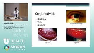 Introduction to Cornea