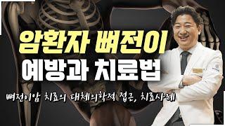 뼈전이 암(골전이암) 치료의 모든 것