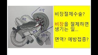 비장절제수술? 비장을 절제하면 생기는 일....면역? 예방접종?