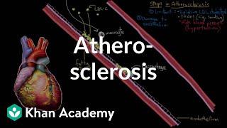 Atherosclerosis | Circulatory System and Disease | NCLEX-RN | Khan Academy