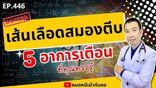 เส้นเลือดในสมองตีบ 5 อาการเตือน ที่คุณควรรู้ | เม้าท์กับหมอหมี EP.446