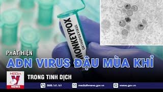 Phát hiện ADN của virus đậu mùa khỉ trong tinh dịch - VNEWS