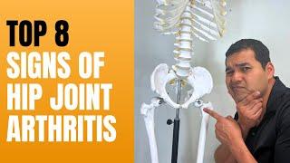 Top 8 Hip Joint Arthritis Symptoms & Signs