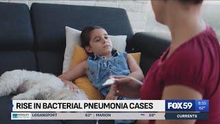 Health experts warning of a rise in bacterial pneumonia cases, symptoms to look for