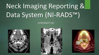 Neck Imaging Reporting and Data System (NI-RADS) Introduction