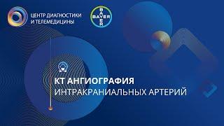 КТ ангиография интракраниальных артерий