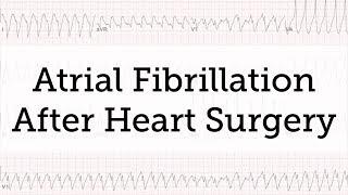 Atrial Fibrillation (AFib) After Heart Surgery: Is it Common?