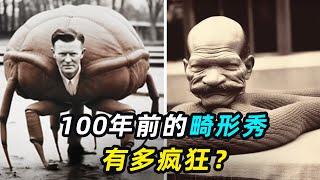 100年前的畸形秀有多疯狂？揭秘全球最可怕的5个畸形人