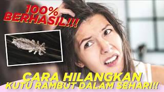 7 Cara Hilangkan Kutu Rambut dan Telurnya Secara Alami, Musnah dalam 1 Hari!