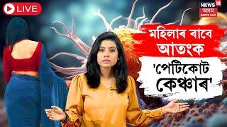 LIVE |  Petticoat Cancer : টানকৈ পেটিকোট পিন্ধিলে হ'ব পাৰে ভয়ংকৰ বিপদ | N18L