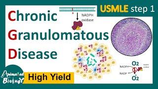 Chronic Granulomatous Disease (CGD) | NADPH oxidase mutation | Respiratory burst | USMLE