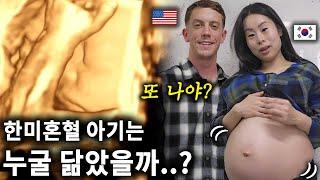 과연 한미 혼혈 아기 얼굴은 누굴 닮았을까..? 두 달 후 둘째 출산..