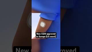 Simplera CGM from Medtronic receives CE Mark in Europe