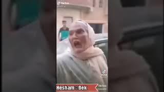 حسد عالهواء مباشرة