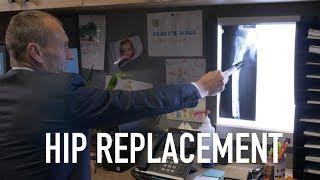 Signs You Need A Hip Replacement