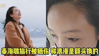 秦海璐被晒伤，曾被称为“最丑影后”，丑小鸭如何逆袭成天鹅？