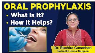 Oral Prophylaxis Step by Step Process | Dental Care Tips | Dr.Ruchira | Eledent Dental Hospitals