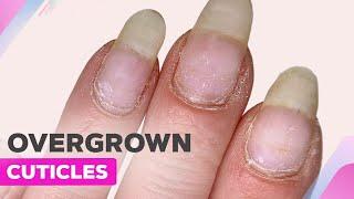 Overcome Dry Cuticle with E-File Tips | Glitter Ombre Nail Art