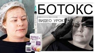 Ботокс видео урок - подсчет единиц, определение зон введения препарата.