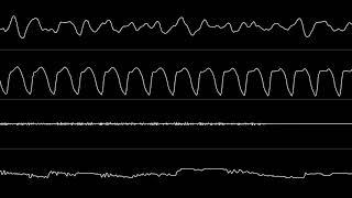 Jogeir Liljedahl - “Addiction” (Amiga MOD) [Oscilloscope View]