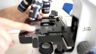 A-Level Biology: Calibration of Eyepiece Graticule with stage micrometer