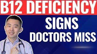 Warning Signs of Vitamin B12 Deficiency You Should Never Ignore