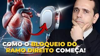 Bloqueio do Ramo Direito: Perigoso? Tem Cura? O que é? Sintomas? Tratamento?