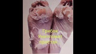 ГРИБОК НОГТЕЙ и ЛЕЧЕНИЕ в ДОМАШНИХ УСЛОВИЯХ. Мощное Средство от Возбудителей.