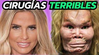 20 Cirugías Que Salieron Terriblemente Mal De Celebridades y Famosos