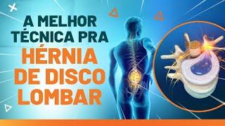 HÉRNIA DE DISCO LOMBAR - MELHOR EXERCÍCIO PARA ALIVIAR A DOR - Fisioprev