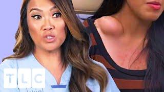 The Contents Of This Huge Bump Surprises Dr Lee | Dr. Pimple Popper