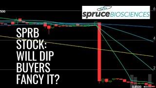 SPRB Stock: 52 Week Low Plunge. Is This The End Of SPRB Stock?