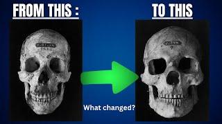 How to increase Bone Mass (Completely change your facial aesthetics)