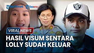 Hasil Visum Sementara Lolly Keluar Hari Ini, Nikmir Temukan Bukti Baru Penjarakan Vadel Badjideh