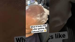 Scalp MicroPigmentation the #1 hair loss treatment! #scalpmicropigmentation #hairloss #shorts