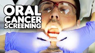 How Oral Cancer Screenings Are Performed