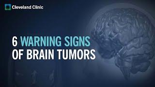 6 Warning Signs of Brain Tumors