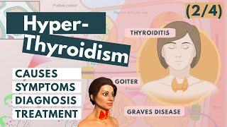 Hyperthyroidism | Graves, Goiter, Thyroiditis | Visual Explanation