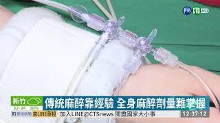 麻醉監測腦波 精準控制劑量更安全 | 華視新聞 20190707