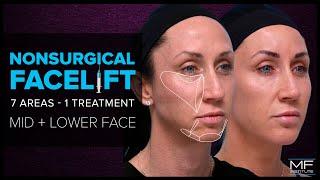 What's a Non Surgical Facelift at Mabrie Facial Institute?