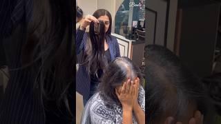 Hair Topper | Hair Extensions | Hair Thinning | Human Hair | Wigs | Beaux | Shorts