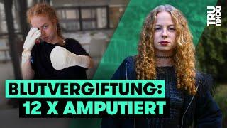 So lebt Justina ohne Finger und Unterschenkel | TRU DOKU